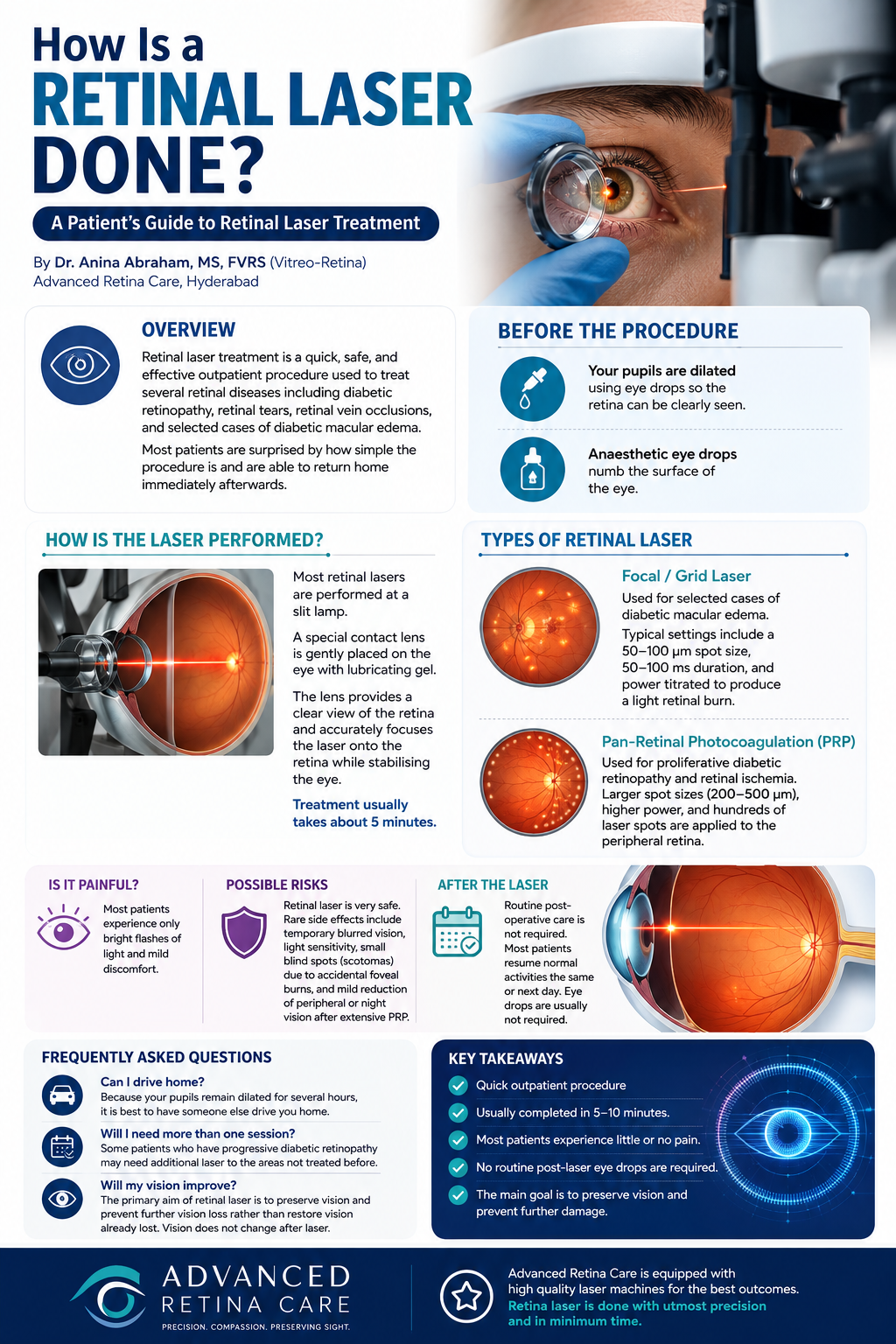 How Is Retinal Laser Done