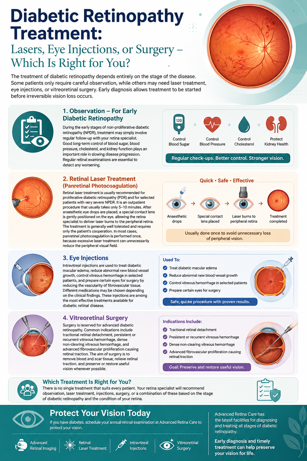 Diabetic Retinopathy Treatment Guide